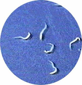 parásitos intestinales oxiuros